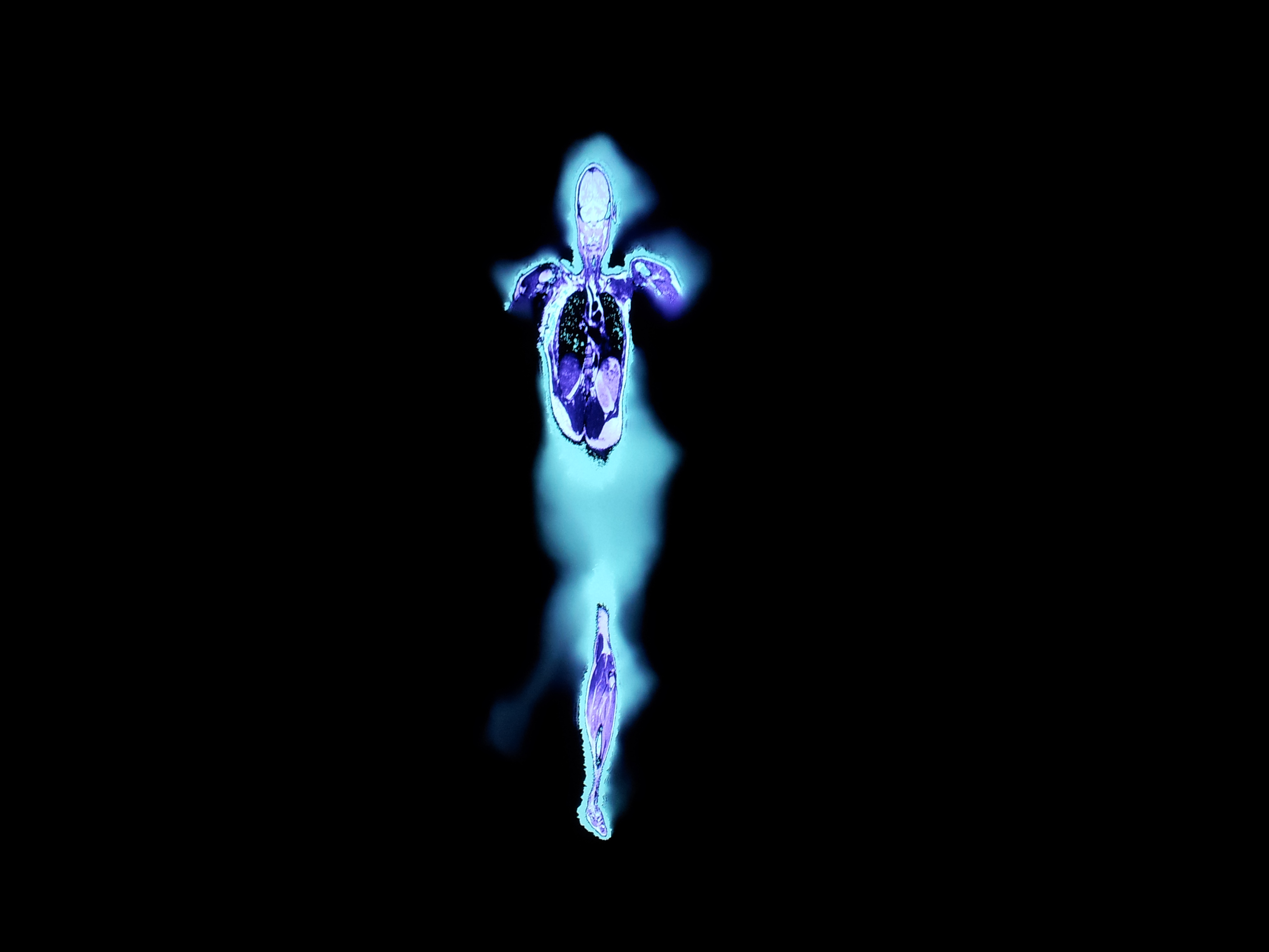2Premiere_Intimite_des_Vues_de_l_esprit_01
